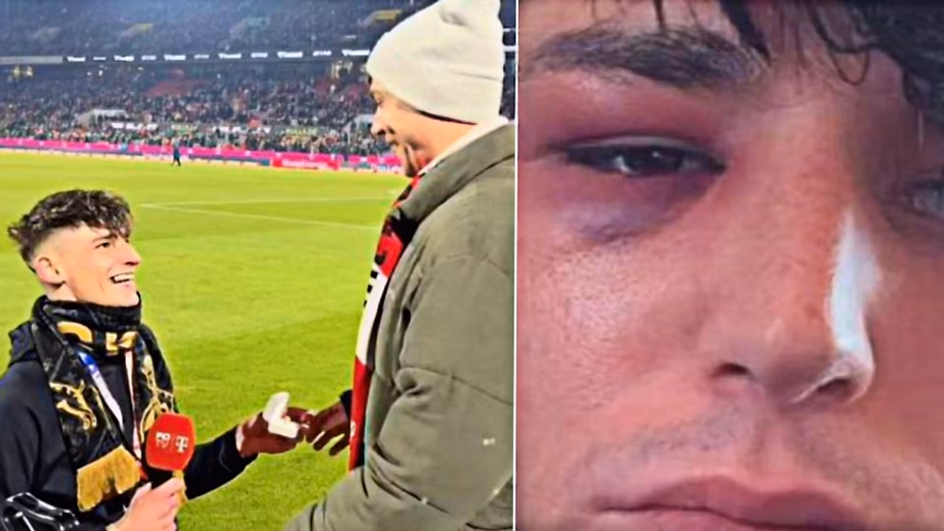 German referee attacked at home after proposing to boyfriend at Bundesliga match