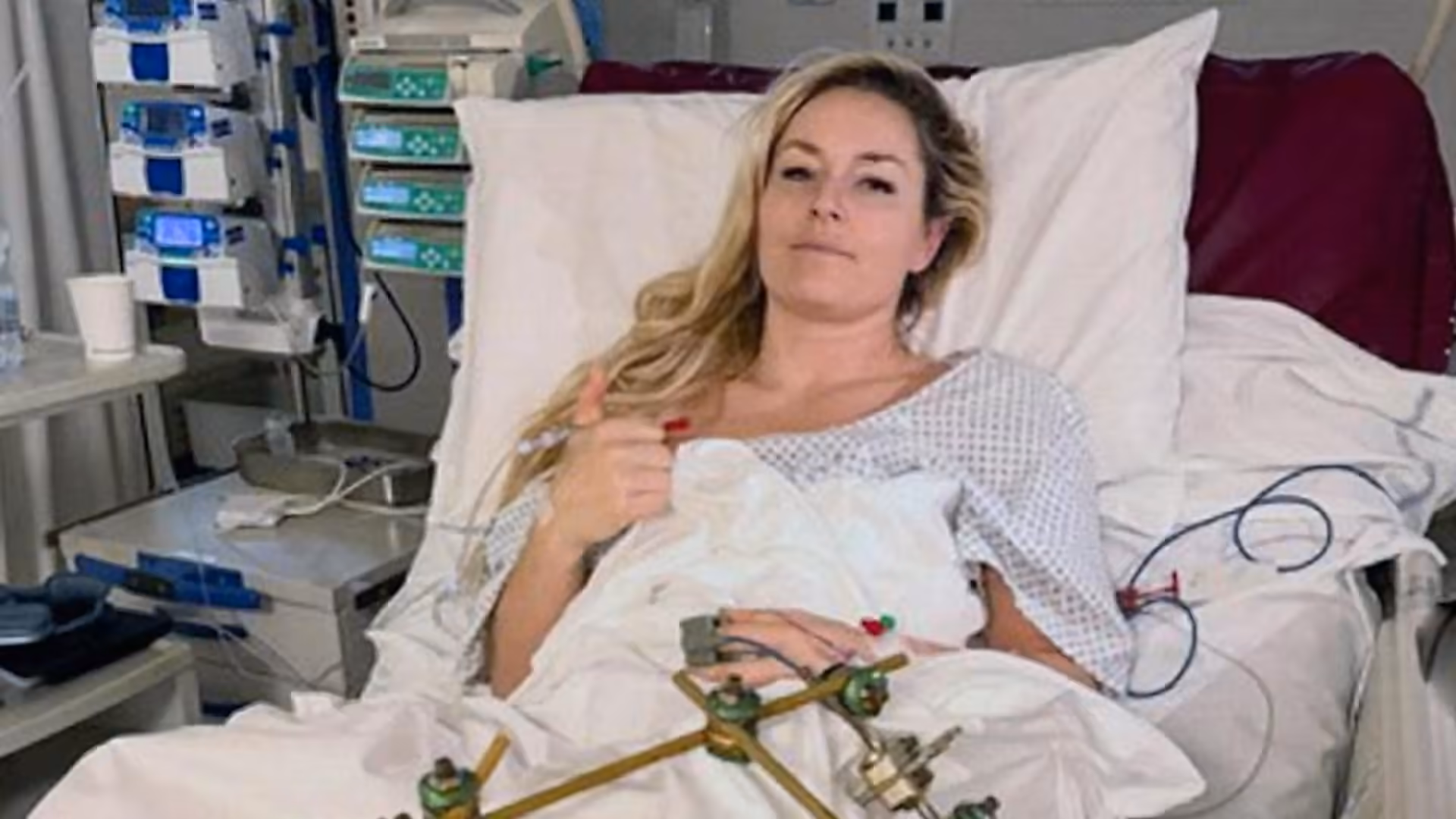 Lindsey Vonn announces fourth surgery after Olympic downhill crash