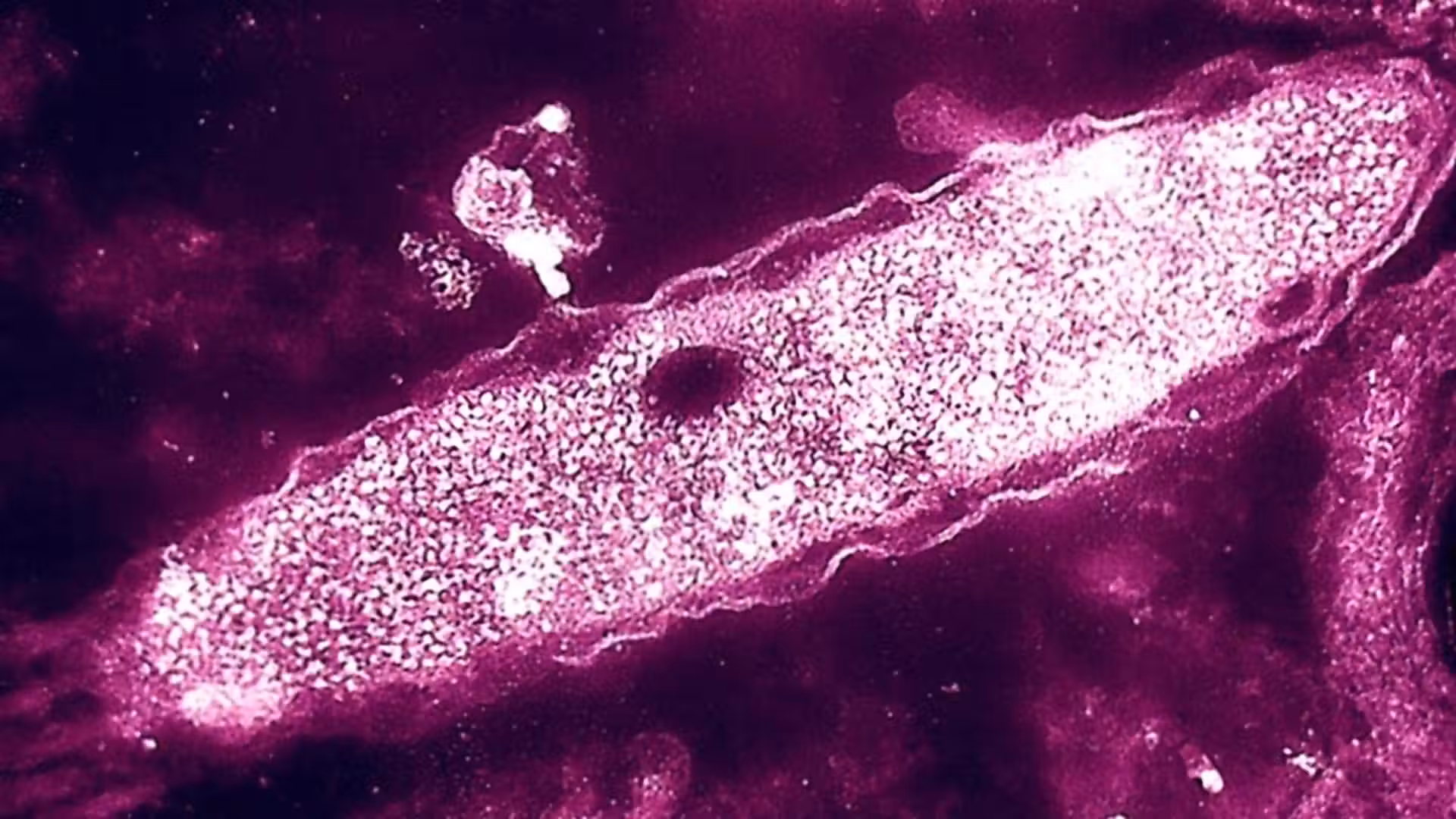 First death reported in Upper East Side Legionnaires' outbreak